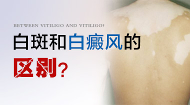 有什么方法可以诊断白癜风